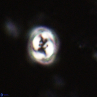 Toweius pertusus 20294