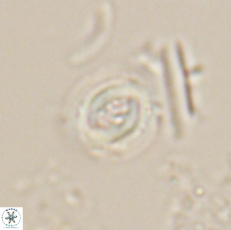 Toweius pertusus 20300
