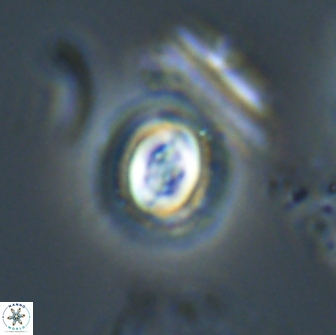Toweius pertusus 20303