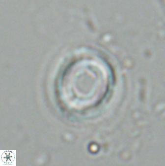 Toweius pseudocallosus 25625