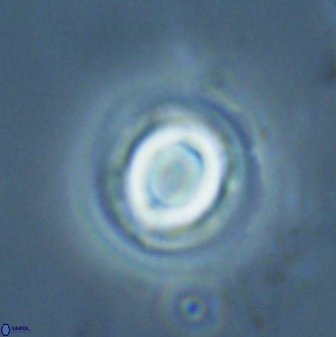 Toweius pseudocallosus 25626