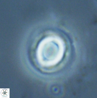 Toweius pseudocallosus 25626