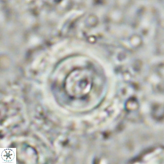Toweius pseudocallosus 48968