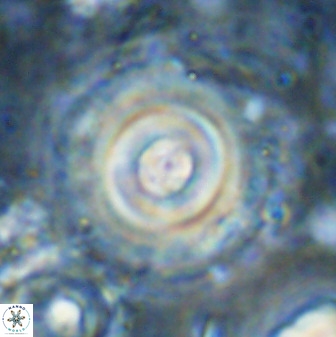 Toweius pseudocallosus 48969