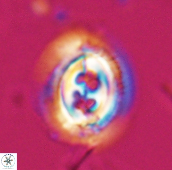 Toweius rigma 25330