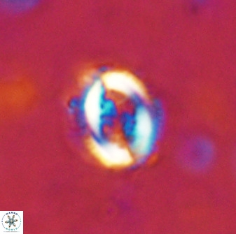 Toweius serotinus 50249