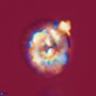 Trachylithos nuryaziciae 22136