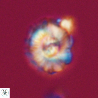 Trachylithos nuryaziciae 22138