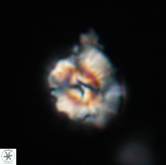 Trachylithos nuryaziciae 22140