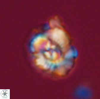Trachylithos nuryaziciae 22142