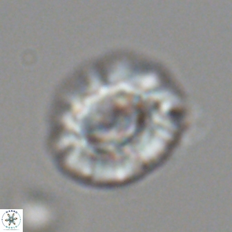 Trachylithos nuryaziciae 22149