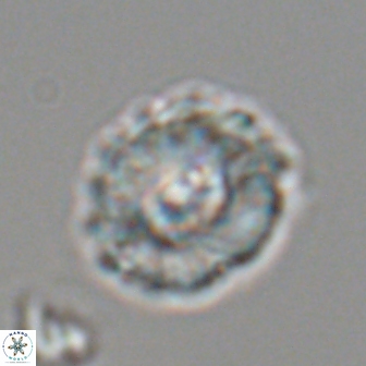 Trachylithos nuryaziciae 22150