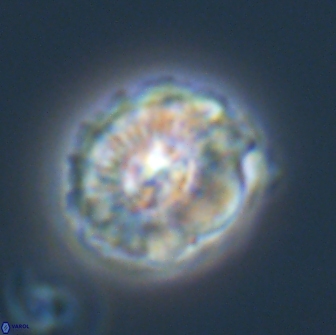 Trachylithos nuryaziciae 22152