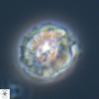 Trachylithos nuryaziciae 22152