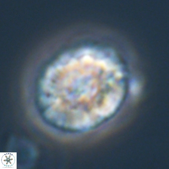 Trachylithos nuryaziciae 22153
