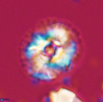 Trachylithos nuryaziciae 22323