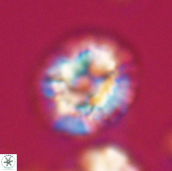 Trachylithos nuryaziciae 22324