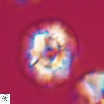 Trachylithos nuryaziciae 22328