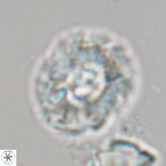 Trachylithos nuryaziciae 22335
