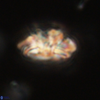 Trachylithos nuryaziciae 69700