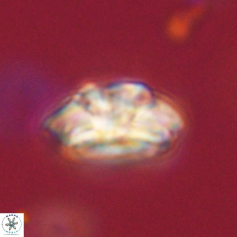 Trachylithos nuryaziciae 69704