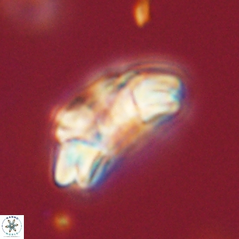 Trachylithos nuryaziciae 69707