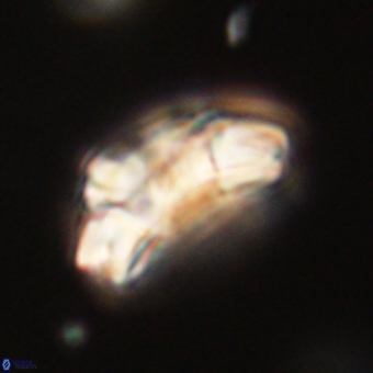 Trachylithos nuryaziciae 69713