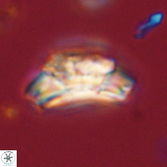 Trachylithos nuryaziciae 69715