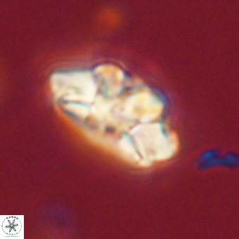 Trachylithos nuryaziciae 69718