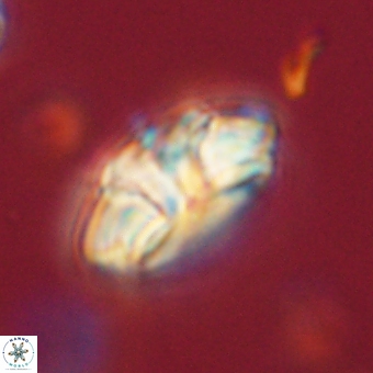 Trachylithos nuryaziciae 69719