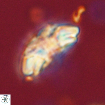 Trachylithos nuryaziciae 69726