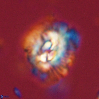 Trachylithos nuryaziciae 69743