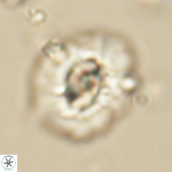 Trachylithos nuryaziciae 69747