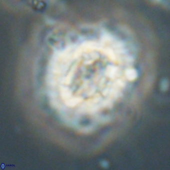 Trachylithos nuryaziciae 69749
