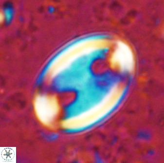Transversapontis duocavus 49164