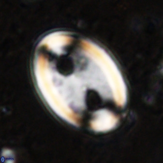 Transversapontis duocavus 49167