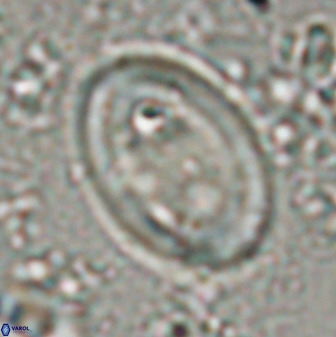 Transversapontis duocavus 49169