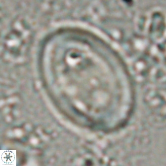 Transversapontis duocavus 49169