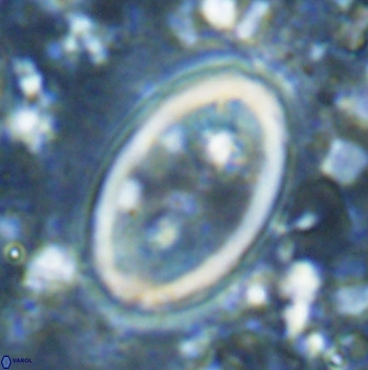 Transversapontis duocavus 49174