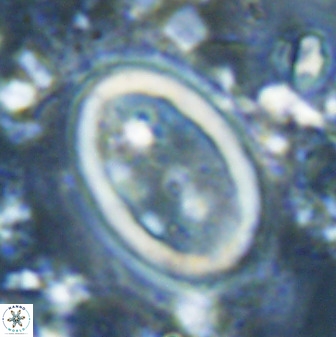 Transversapontis duocavus 49171