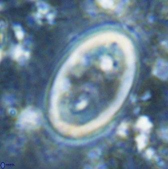 Transversapontis duocavus 49173