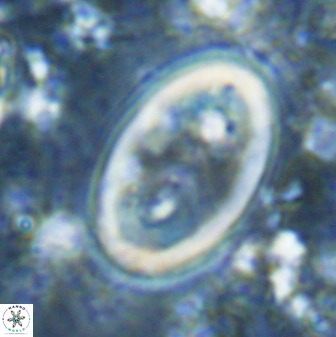 Transversapontis duocavus 49173