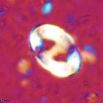 Transversopontis pulcher 48907