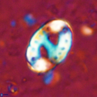 Transversopontis pulcher 48911