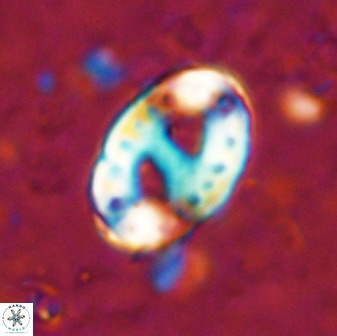 Transversopontis pulcher 48911