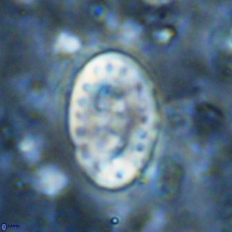 Transversopontis pulcher 48913