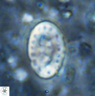 Transversopontis pulcher 48913