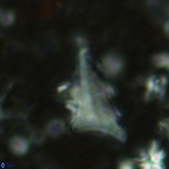 Triamutilaferrum donti VR 16888