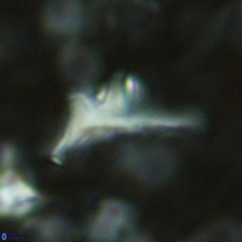 Triamutilaferrum donti VR 16892