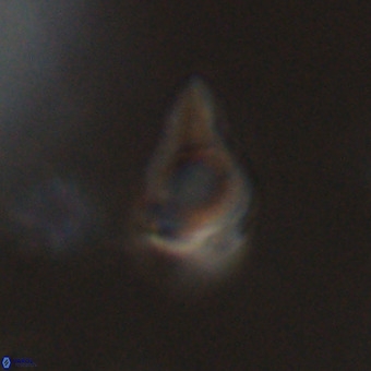 Triamutilaferrum donti VR 20081